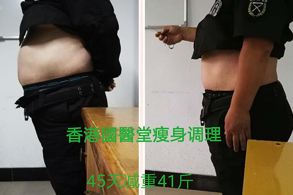 許昌瘦瘦包女子綜合怎么代理